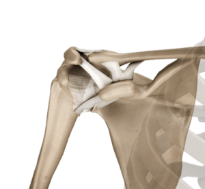 AC Joint Separation 