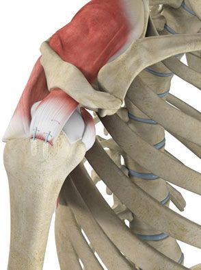 Arthroscopic Rotator Cuff Repair