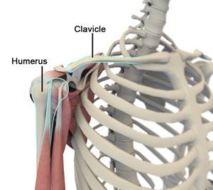 Treatment of Cartilage Injuries