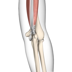 triceps-tendon-repair